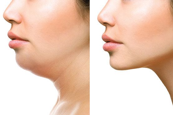 Transforming Confidence Through Modern Cosmetic Surgery